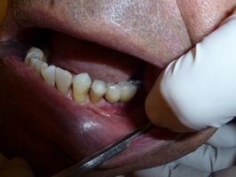 Ефектни Dental Implants 36