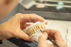 Информация за Dental Implants 5