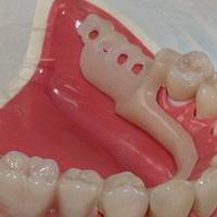 More for Dental Implants Bulgaria 1