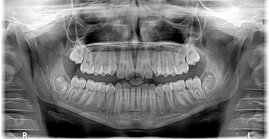 Take a look at Dental Implants Bulgaria 39