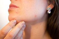 Разгледайте хайфу лифтинг 21 от DermaVita Разгледайте хайфу лифтинг 21