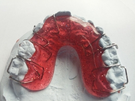 Learn more about Invisalign 36