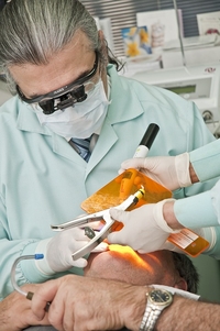 Видове избелване на зъби 9