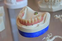 Най-добрите оферти за Ортодонтско лечение 21 от The Smile Company Най-добрите оферти за Ортодонтско лечение 21