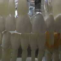 Разнообразие от пародонтологично лечение 1 от MedicalDent Разнообразие от пародонтологично лечение 1