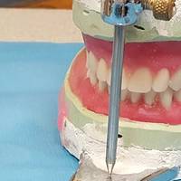 Огромно разнообразие от пародонтологично лечение 17 от MedicalDent Огромно разнообразие от пародонтологично лечение 17