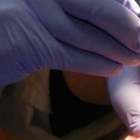 Оферти за пародонтологично лечение 18 от MedicalDent Оферти за пародонтологично лечение 18