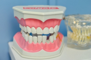 Ефектни зъбни импланти 3