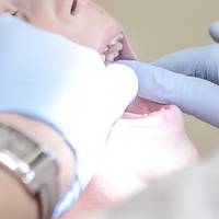 Най-добрите зъбни импланти и мостове 23 от MedicalDent Най-добрите зъбни импланти и мостове 23