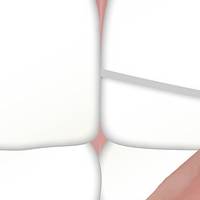 Намерете фасети 40 от DsDent Намерете фасети 40