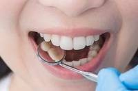 зъболекар русе - 15930 - вземете от наште продукти