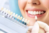 избелване на зъби цена - 21222 клиенти | Dentalcare избелване на зъби цена - 76157 клиенти