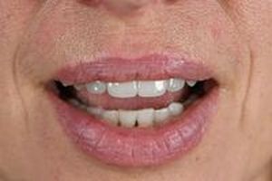 дентална клиника софия - 5259 награди | Supreme Dental дентална клиника софия - 32762 награди